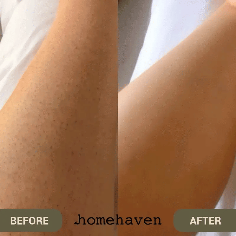 Reusable Nano Crystal Hair Remover – Painless Exfoliating Epilator for Smooth Skin